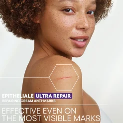 A-Derma Epitheliale Ultra Repair HA+ Anti-Marks Repairing Cream 100ml (3.38floz)