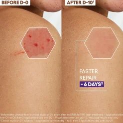 A-Derma Epitheliale Ultra Repair HA+ Anti-Marks Repairing Cream 100ml (3.38floz)