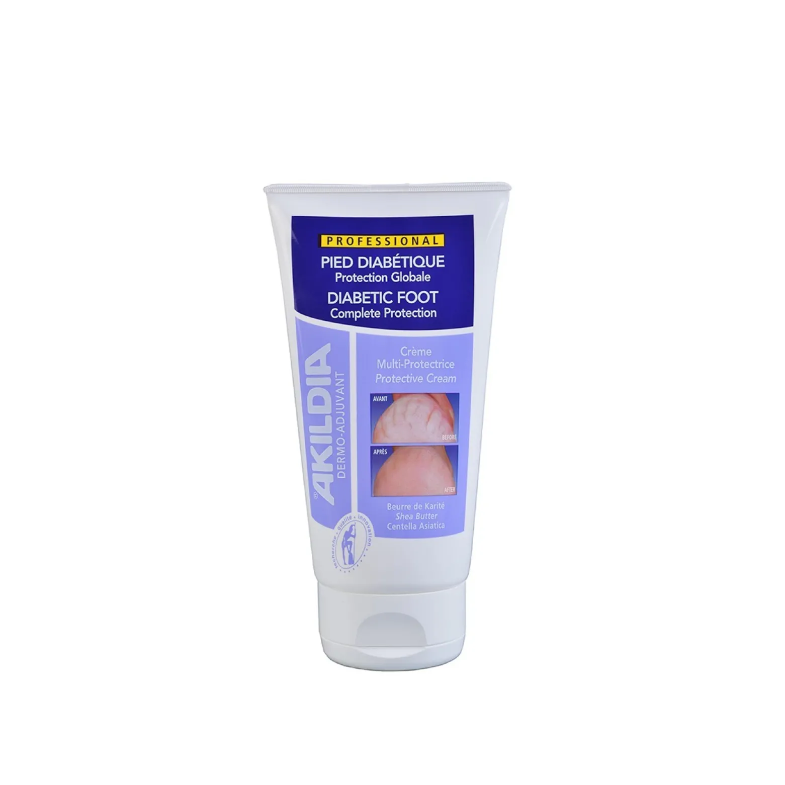 Akildia Diabetic Foot Protective Cream 150ml (5.07floz)