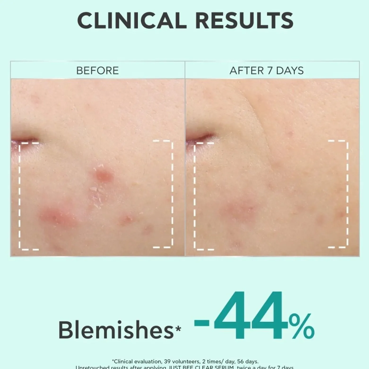 APIVITA Just Bee Clear Refining Serum 30ml (1.01floz)