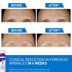 CeraVe Skin Renewing Retinol Serum 30ml (1floz)