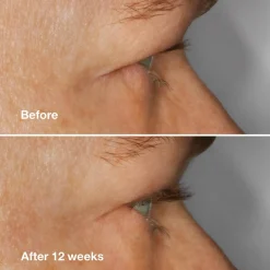 Clinique High Impact Lash Amplifying Serum 3g (0.1floz)