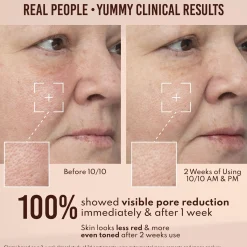 Danessa Myricks Beauty Yummy Skin 10/10 Barrier Boost Hyaluronic Acid + Ectoin Plumping Serum 50ml (1.69floz)