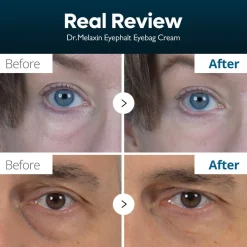 Dr.Melaxin Eyephalt Eyebag Cream 10g (0.35oz)