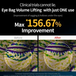 Dr.Melaxin Eyephalt Eyebag Cream 10g (0.35oz)