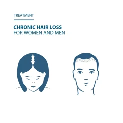 Ducray Anacaps Expert for Chronic Hair Loss 3x30