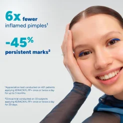 Ducray Keracnyl PP+ Anti-Blemish Cream Acne-Prone Skin 30ml (1.01floz)