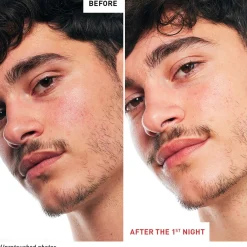 Erborian Skin Therapy Multi-Perfecting Night Oil 30ml (1floz)