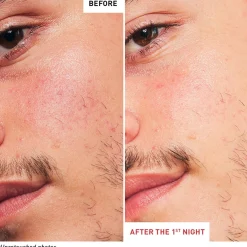 Erborian Skin Therapy Multi-Perfecting Night Oil 30ml (1floz)