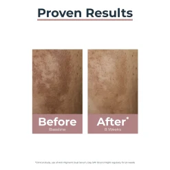 Eucerin Anti-Pigment Day Cream SPF30 Dark Spots 50ml (1.69floz)