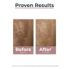 Eucerin Anti-Pigment Dual Serum Dark Spots 30ml (1.01floz)