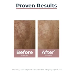 Eucerin Anti-Pigment Dual Serum Dark Spots 30ml (1.01floz)