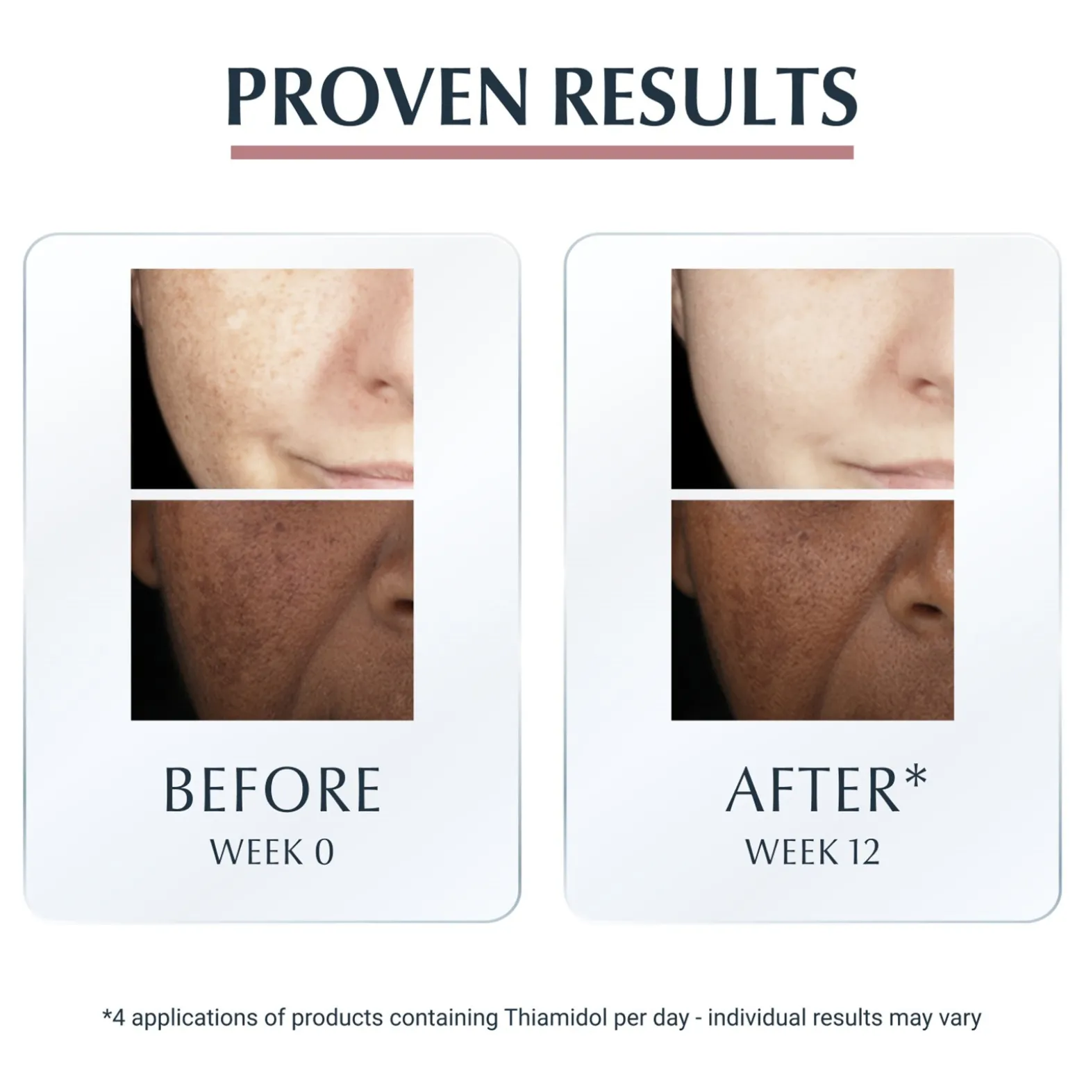 Eucerin Anti-Pigment Spot Corrector Dark Spots 5ml (0.17floz)