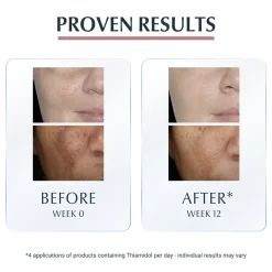 Eucerin Anti-Pigment Spot Corrector Dark Spots 5ml (0.17floz)