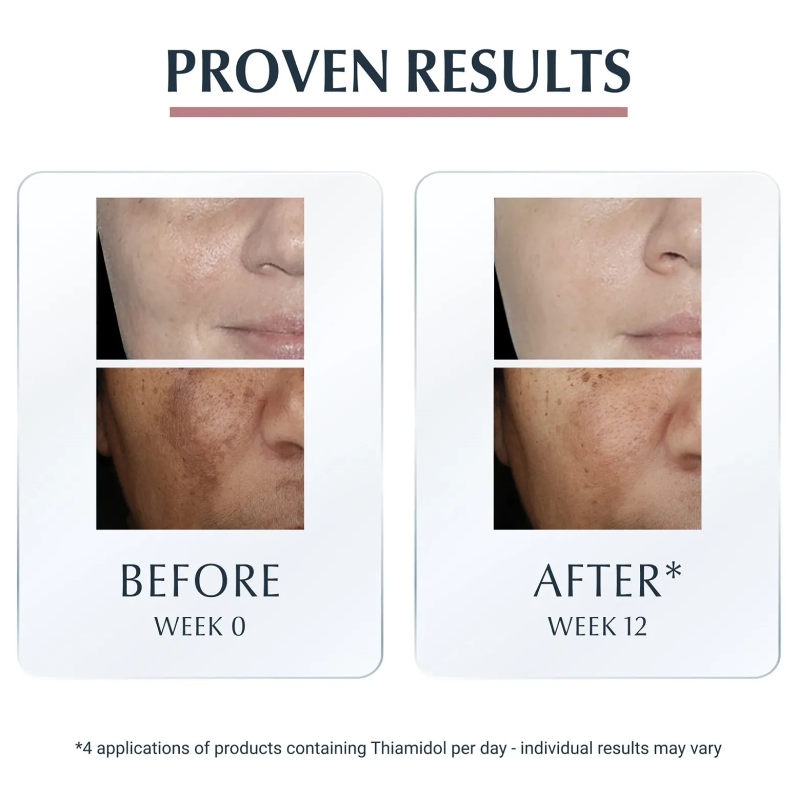Eucerin Anti-Pigment Spot Corrector Dark Spots 5ml (0.17floz)