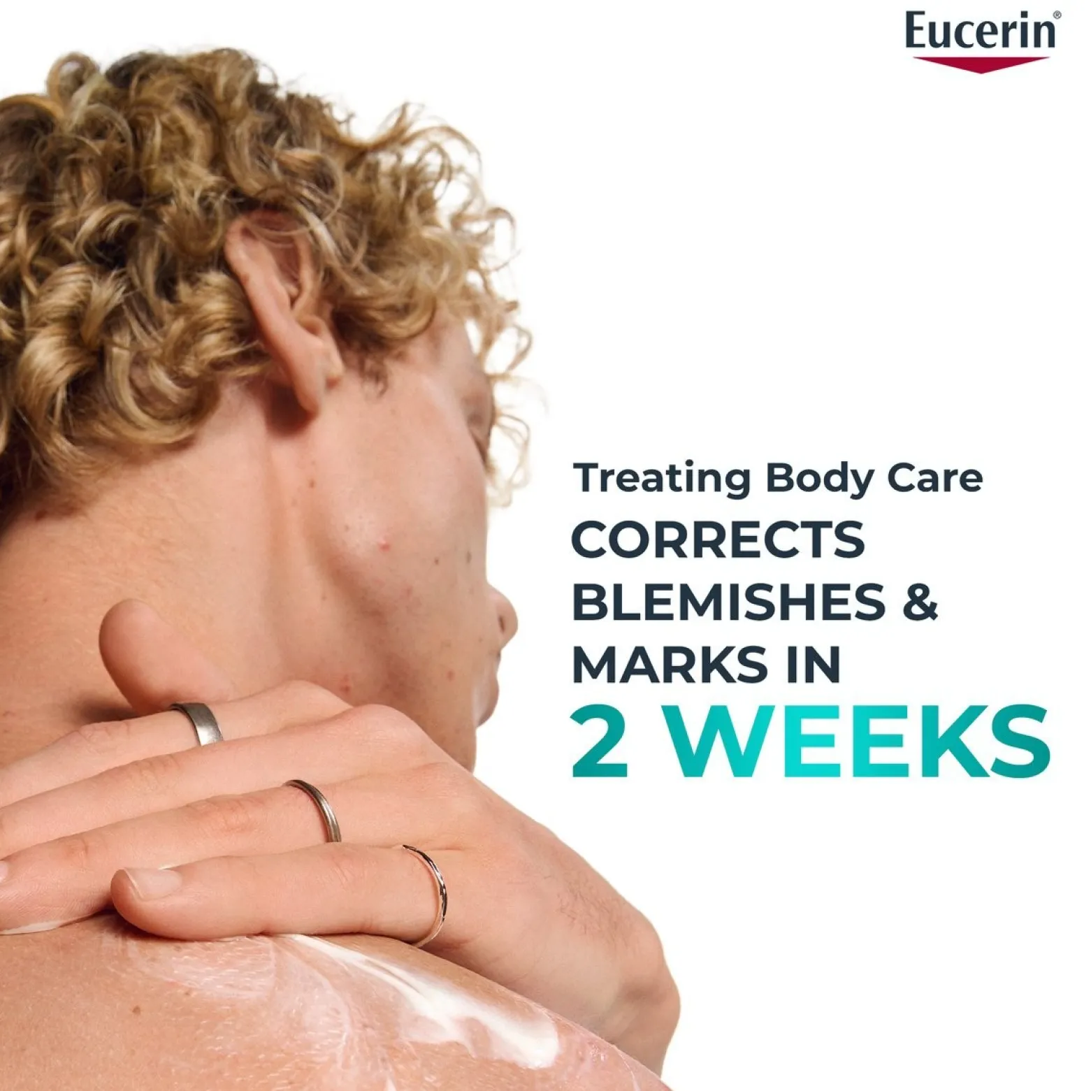 Eucerin DERMOPURE Clinical Correcting Body Care 200ml (6.76floz)