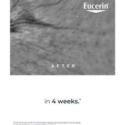 Eucerin Hyaluron-Filler Epigenetic Serum Anti-Age 30ml (1.01floz)