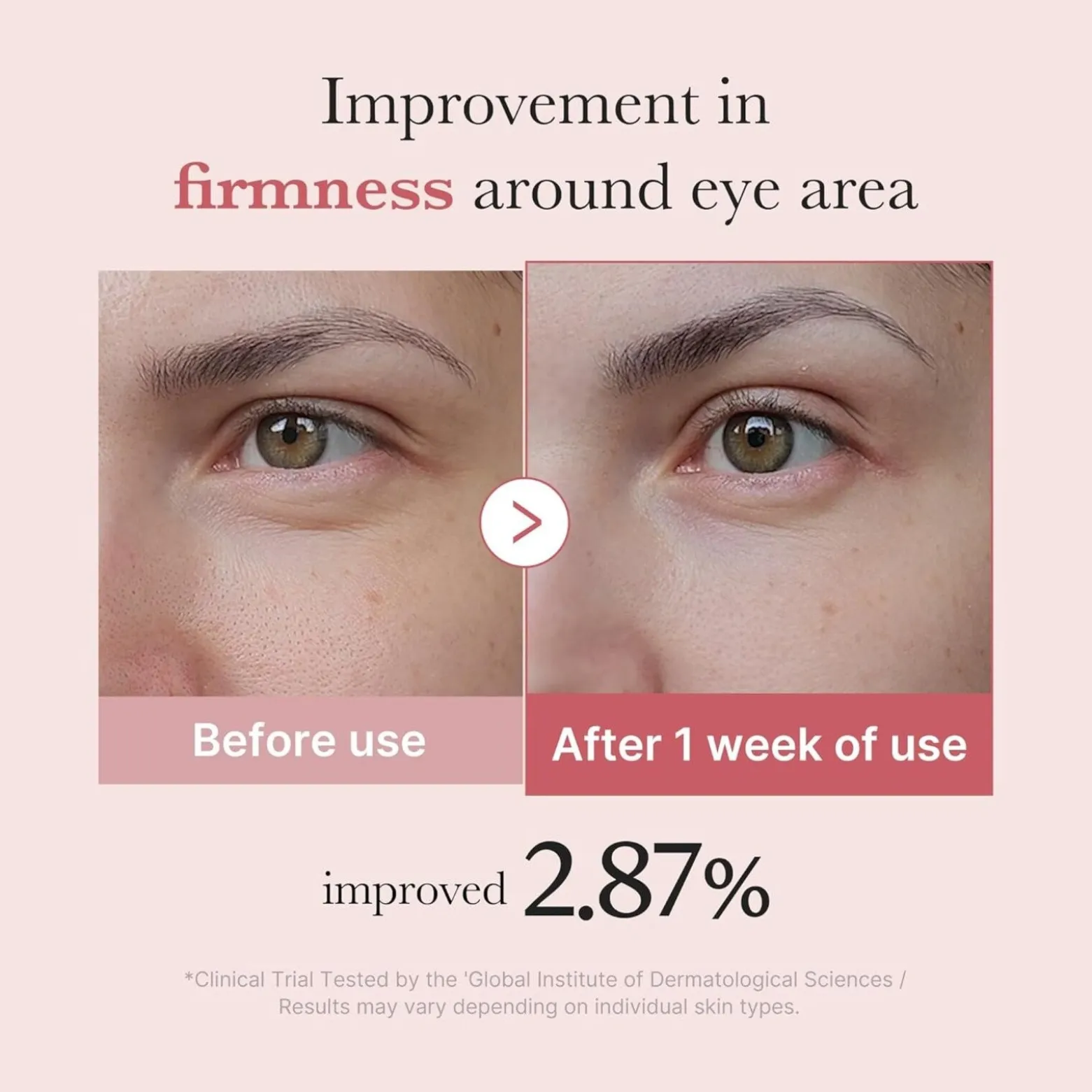Medicube PDRN Pink Peptide Eye Cream 30ml (1.01floz)