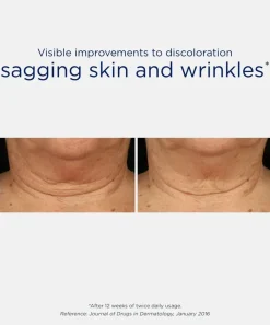 NeoStrata Skin Active Triple Firming Neck Cream 80g (2.82oz)