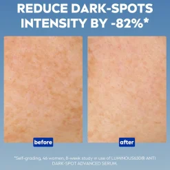 Nivea Luminous 630 Anti-Dark Spots Advanced Serum 30ml (1.01fl oz)