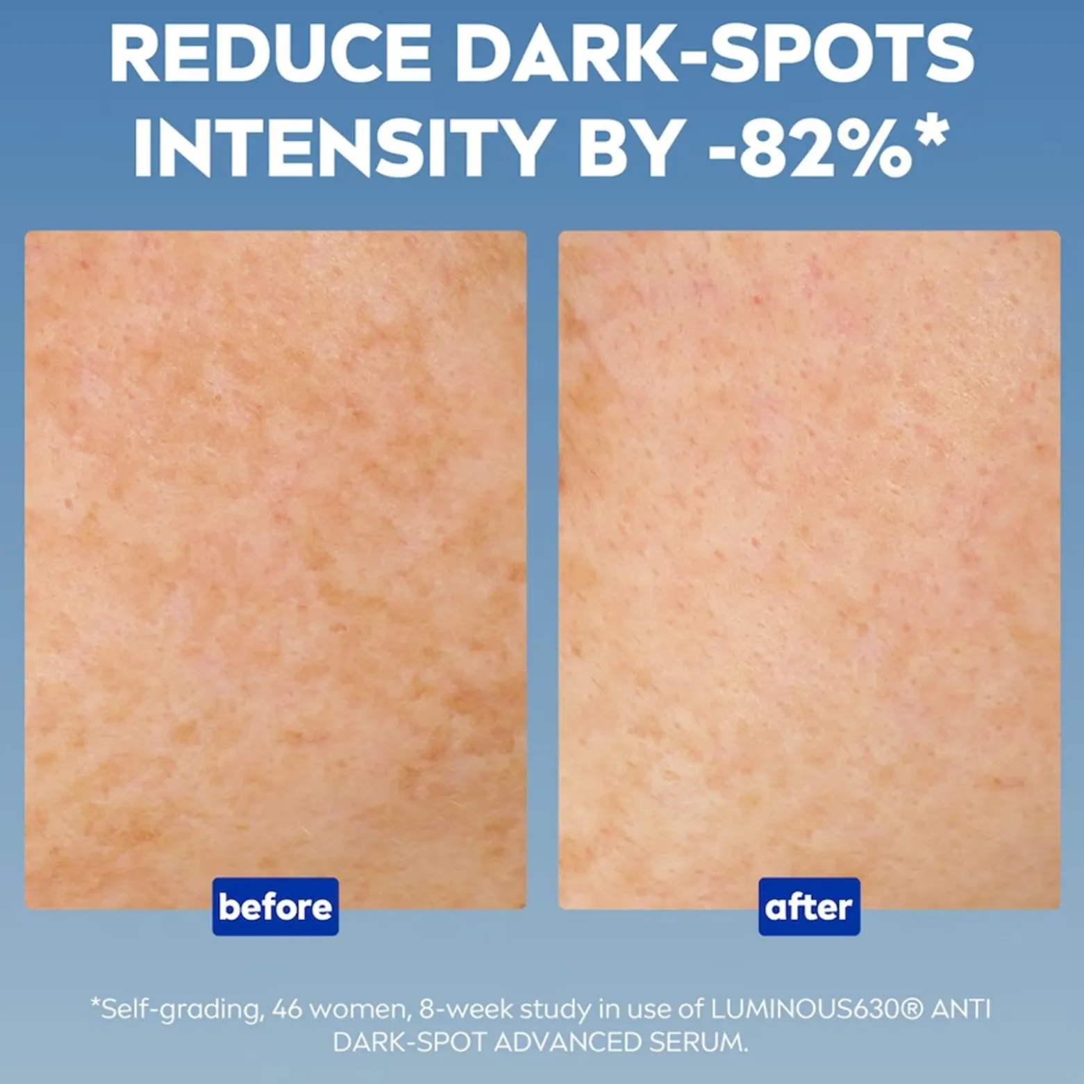 Nivea Luminous 630 Anti-Dark Spots Advanced Serum 30ml (1.01fl oz)