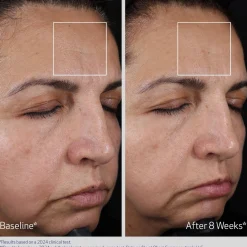 Obagi Elastiderm Advanced Filler Concentrate 20ml (0.68floz)