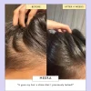 UpCircle Scalp + Hair Oil 50ml (1.69floz)