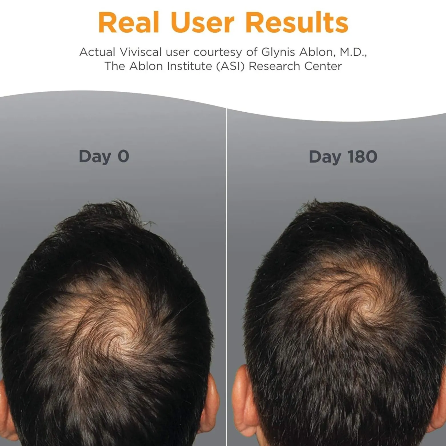 Viviscal Man Healthy Hair Vitamins Supplement Tablets Hair Loss x180